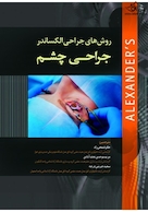 روش های جراحی الکساندر 2019 جراحی چشم